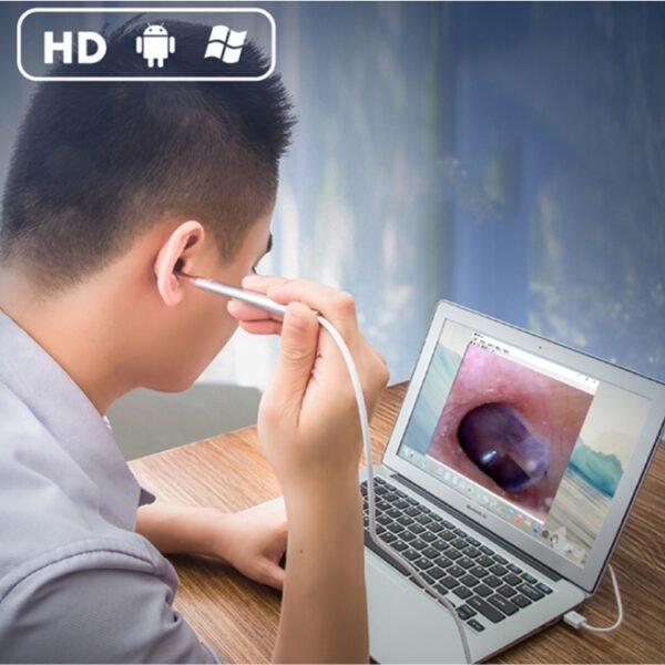 1MP HD Visual Ear Nose Tooth Endoscope Borescope with 6 LEDs, Lens Diameter: 3.9mm(Silver) - Image 7